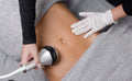 6 seances lipocavitation a nice 